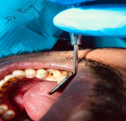 emergency dentist in mussafah