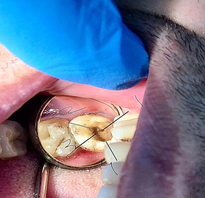 kids dentist in mussafah